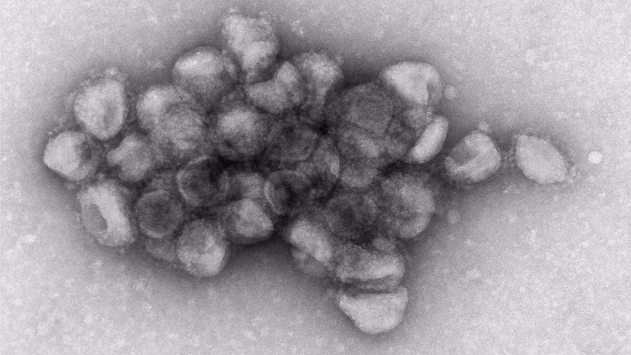  Imagen de microscop&iacute;a electr&oacute;nica de un agregado de part&iacute;culas virales pseudotipadas con la prote&iacute;na de espiga de la variante Delta del SARS-CoV-2 