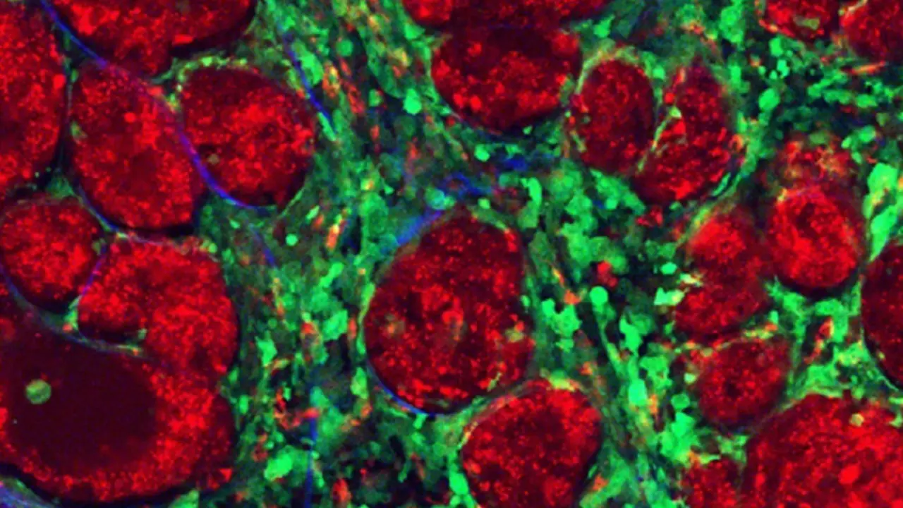  Archivo - Los componentes de un tumor. - IBBTEC - Archivo 