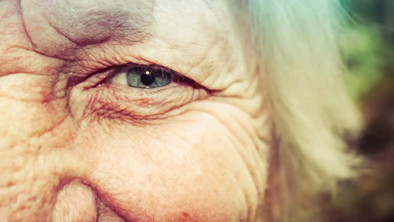  Envejecimiento de la piel 