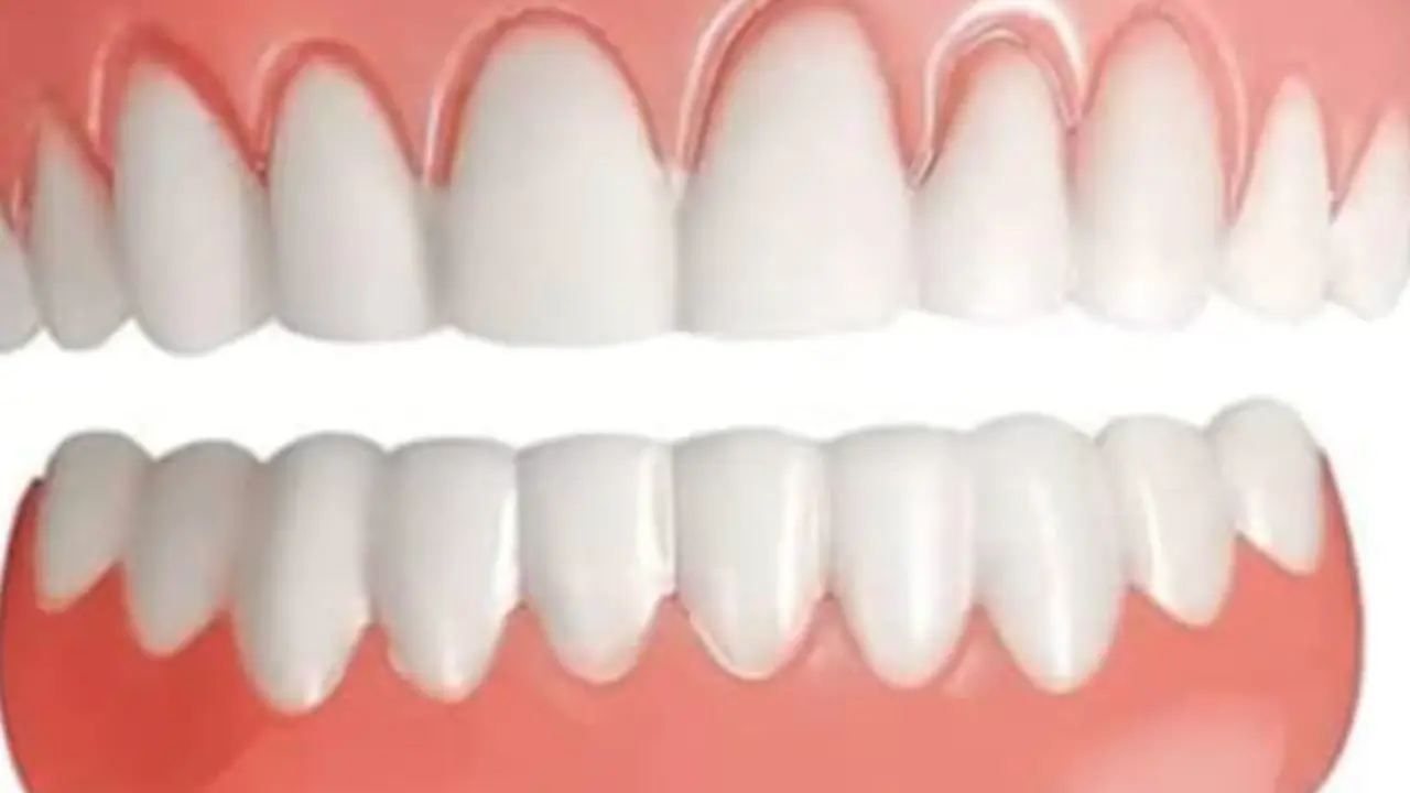  Dentadura postiza. AMAZON 