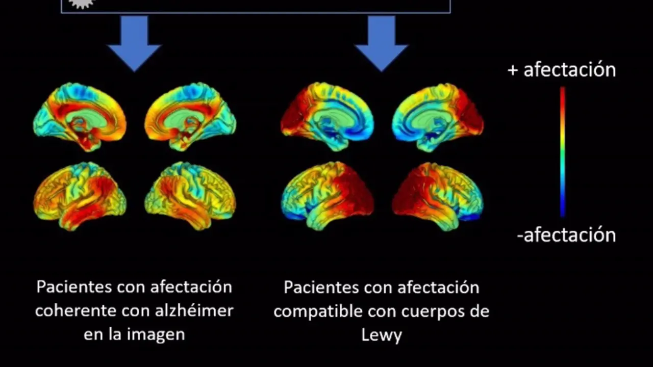  Infograf&iacute;a ilustrativa sobre las t&eacute;cnicas de imagen m&eacute;dica. - IBIS 