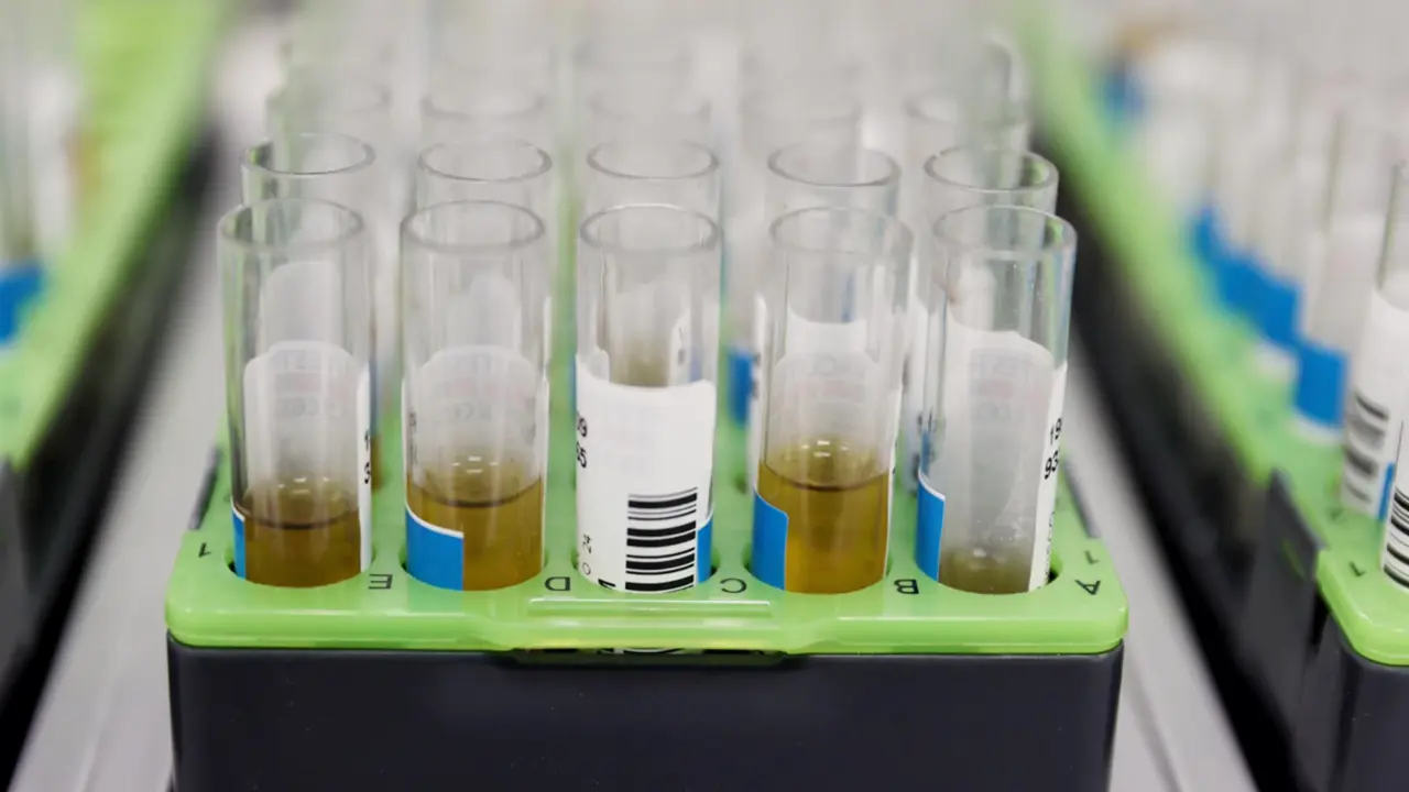  Archivo - Probetas de pruebas para el diagn&oacute;stico de la viruela del mono - Eduardo Parra - Europa Press - Archivo 