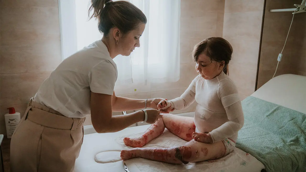  Elena Mart&iacute;n Corradini y su peque&ntilde;a con piel de mariposa 
