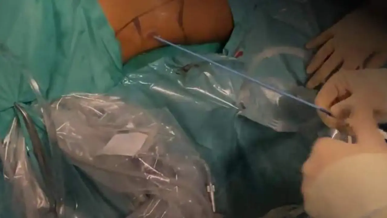  Captura del v&iacute;deo de la intervenci&oacute;n 