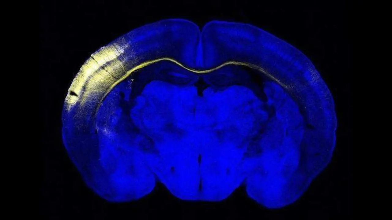  Nueronas en el cerebro 