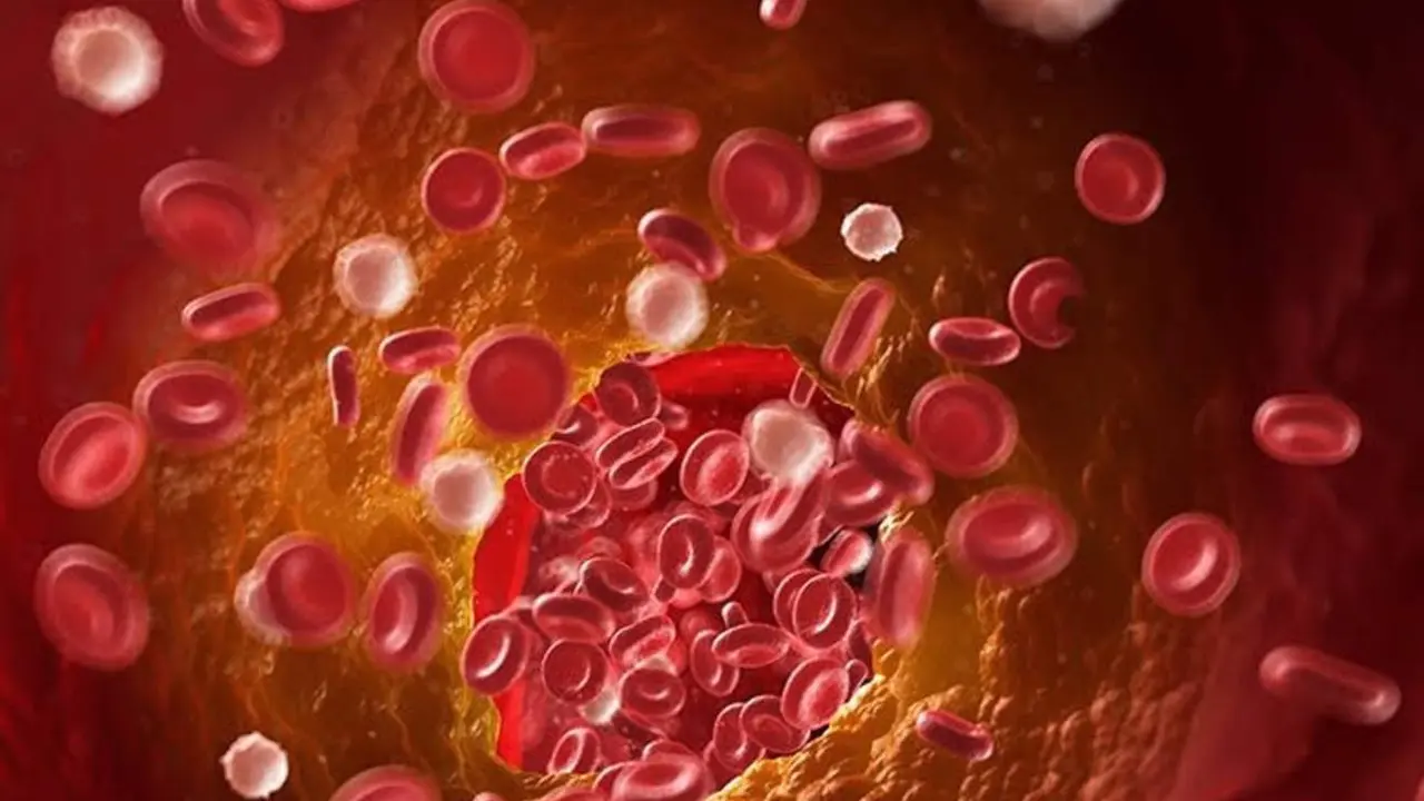  Archivo - Sangre. - UNIVERSIDAD POLIT&Eacute;CNICA DE MADRID - Archivo 