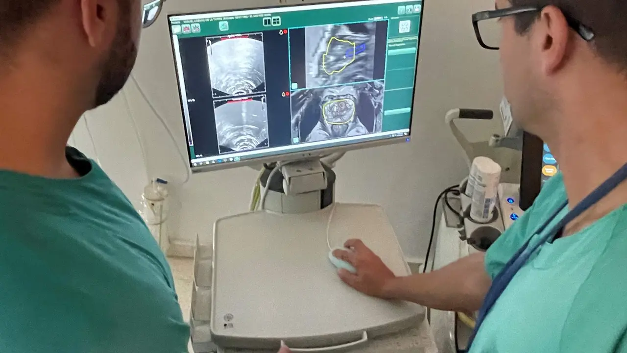  Biopsia para detectar el c&aacute;ncer  de pr&oacute;stata en urolog&iacute;a. 