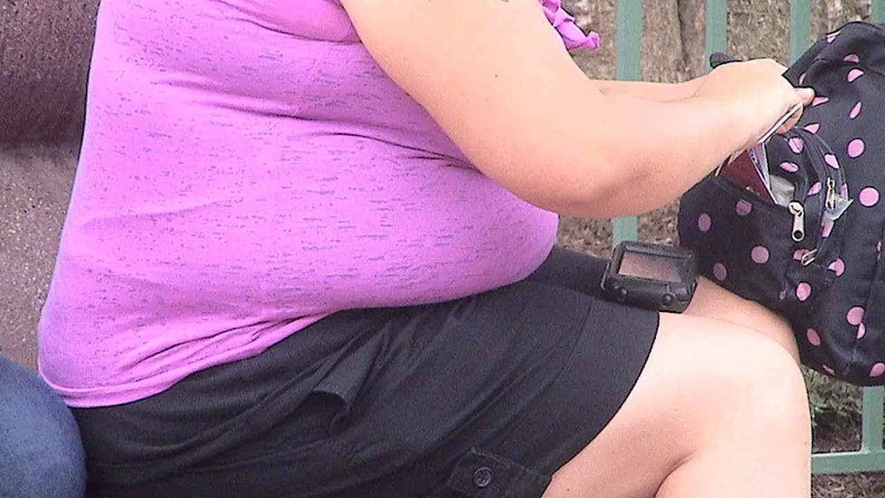  Mujer con obesidad 
