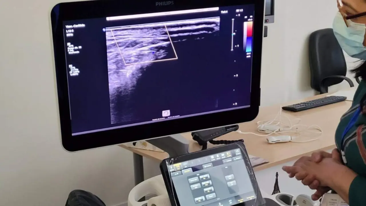  Archivo - Ec&oacute;grafo. - SEMI - Archivo 