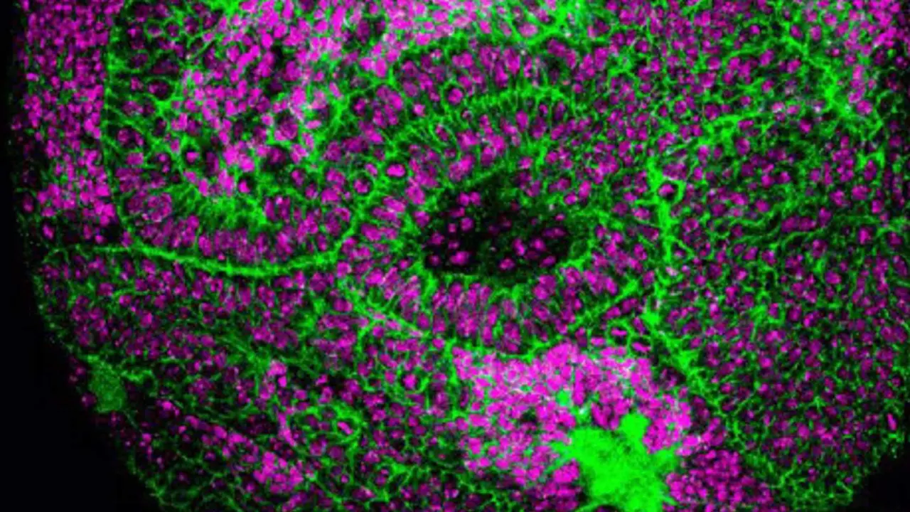  Imagen del estudio sobre los genes germinales y su papel en el desarrollo de tumores cerebrales en la mosca Drosophila - IRB BARCELONA 