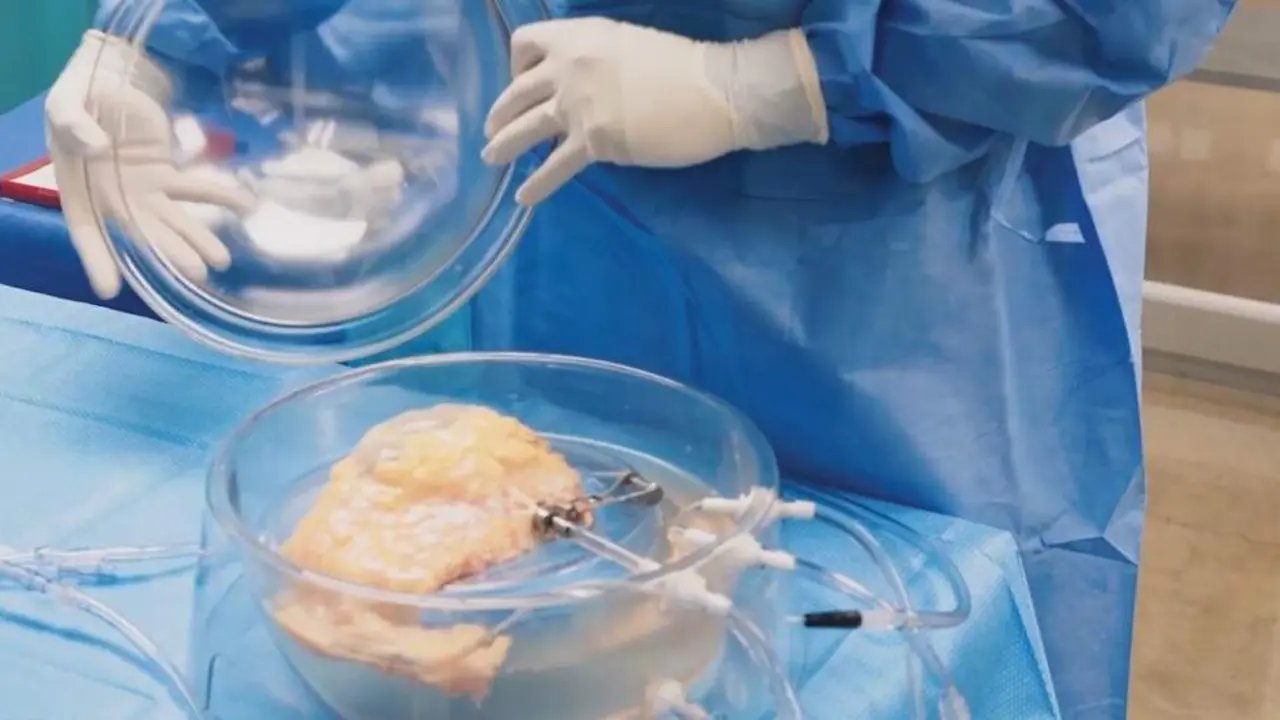  El equipo de 34 vidas con un ri&ntilde;&oacute;n 