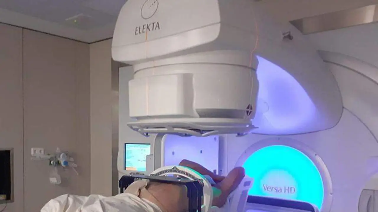  Paciente de c&aacute;ncer de pulm&oacute;n recibiendo tratamiento con un acelerador lineal 