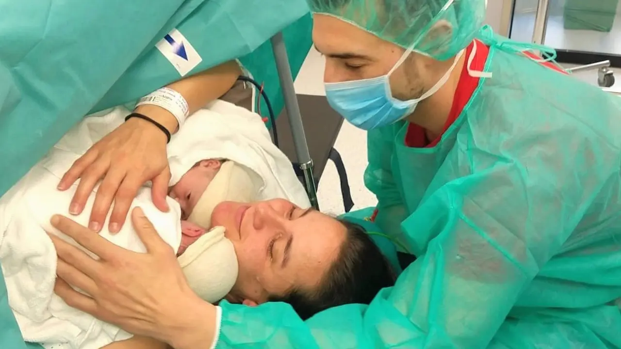  Ces&aacute;rea gemelar 