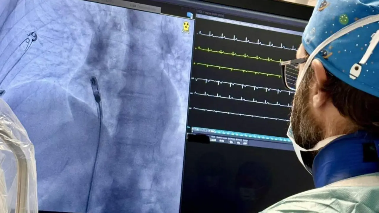  Reparar una v&aacute;lvula con cat&eacute;ter beneficia a pacientes con insuficiencia card&iacute;aca, seg&uacute;n un estudio - HOSPITAL GERMANS TRIAS I PUJOL 