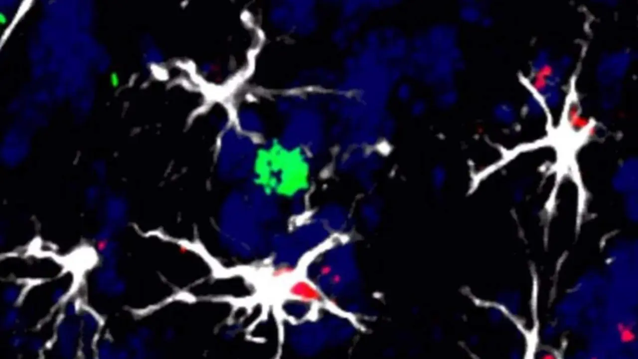  C&eacute;lulas en torno a una met&aacute;stasis cerebral en modelo animal - CNIO 