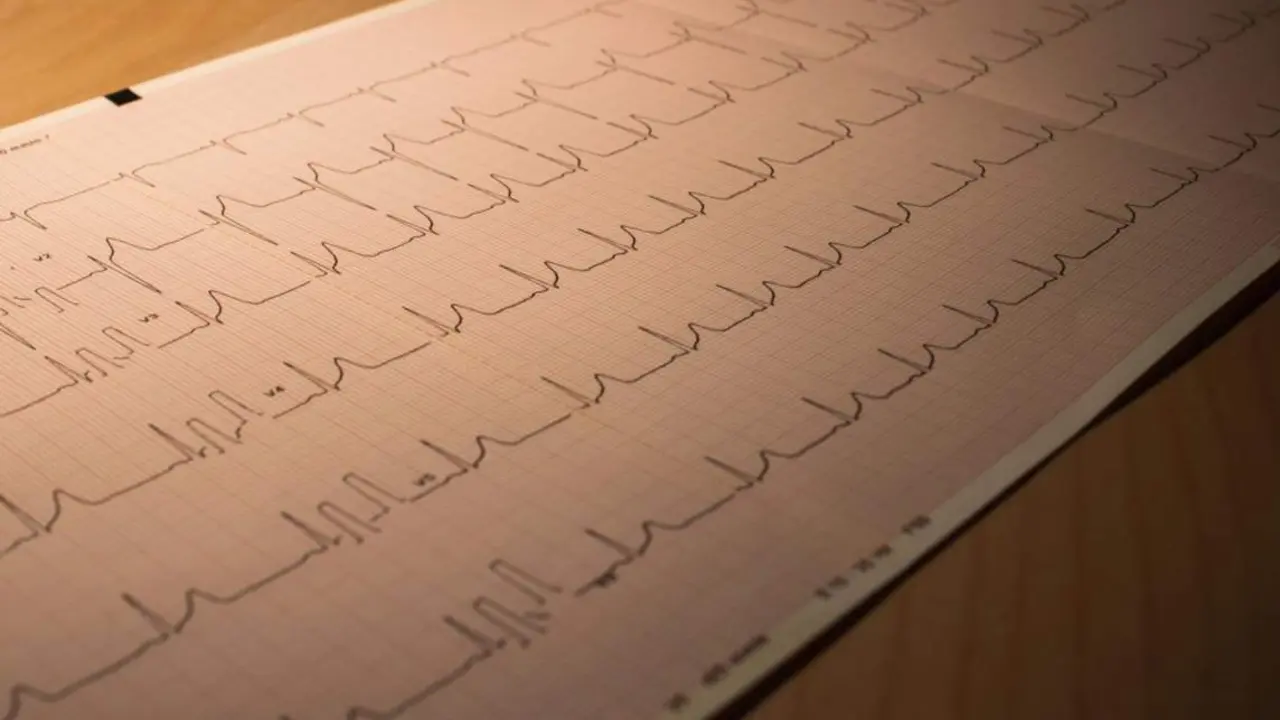  Imagen que ilustra el estudio 'Cardiobar&oacute;metro espa&ntilde;ol' - IBS.GRANADA 