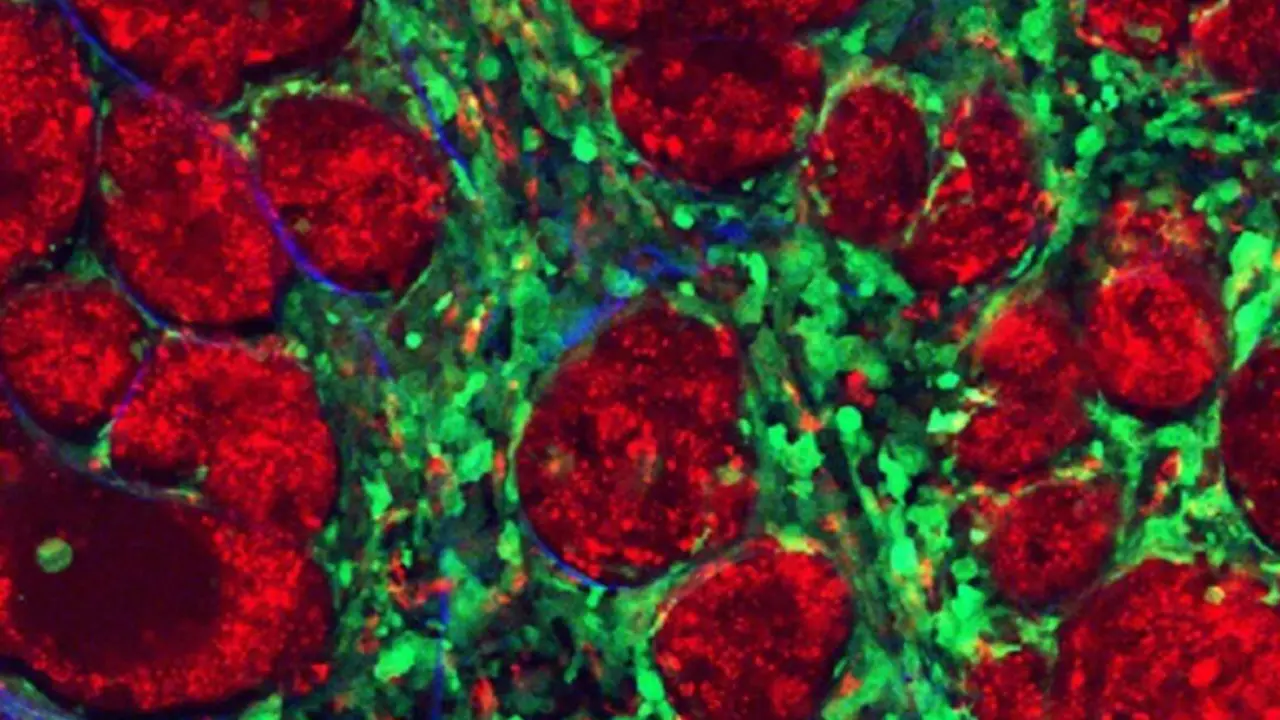  Archivo - Los componentes de un tumor. - IBBTEC - Archivo 