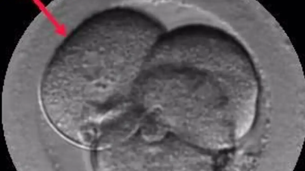  Embri&oacute;n Multinucleado. - Institut Marqu&egrave;s 