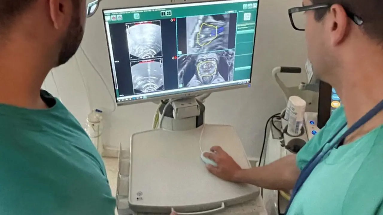  Biopsia para detectar el c&aacute;ncer  de pr&oacute;stata en urolog&iacute;a. 