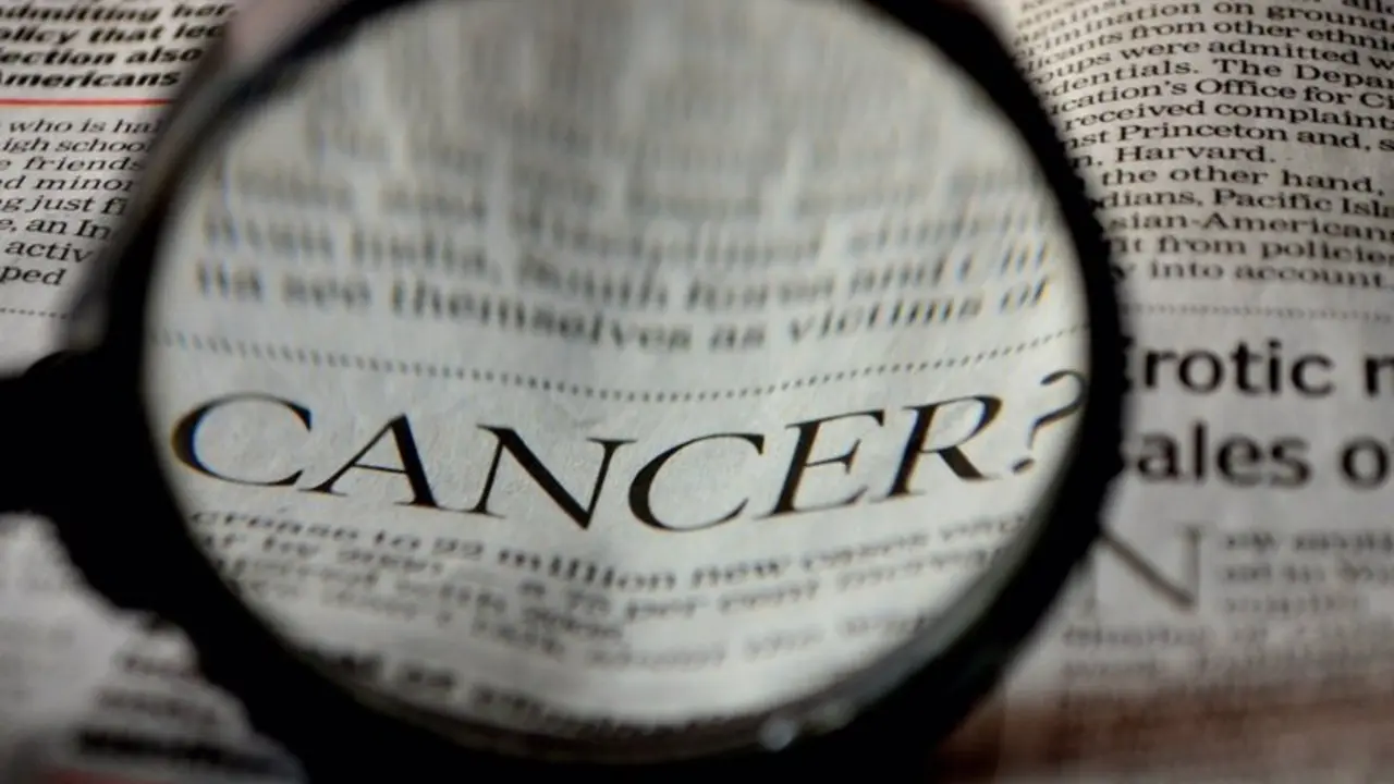  Archivo - C&aacute;ncer - GMV - Archivo 