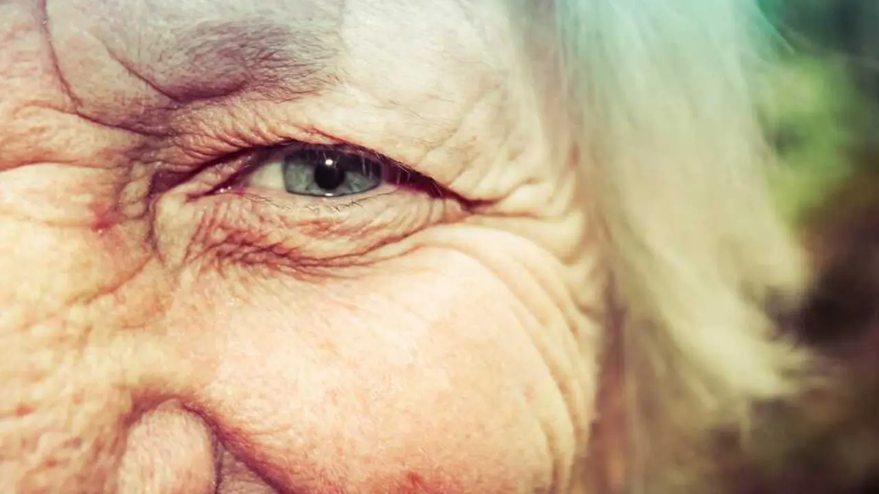  Envejecimiento de la piel 