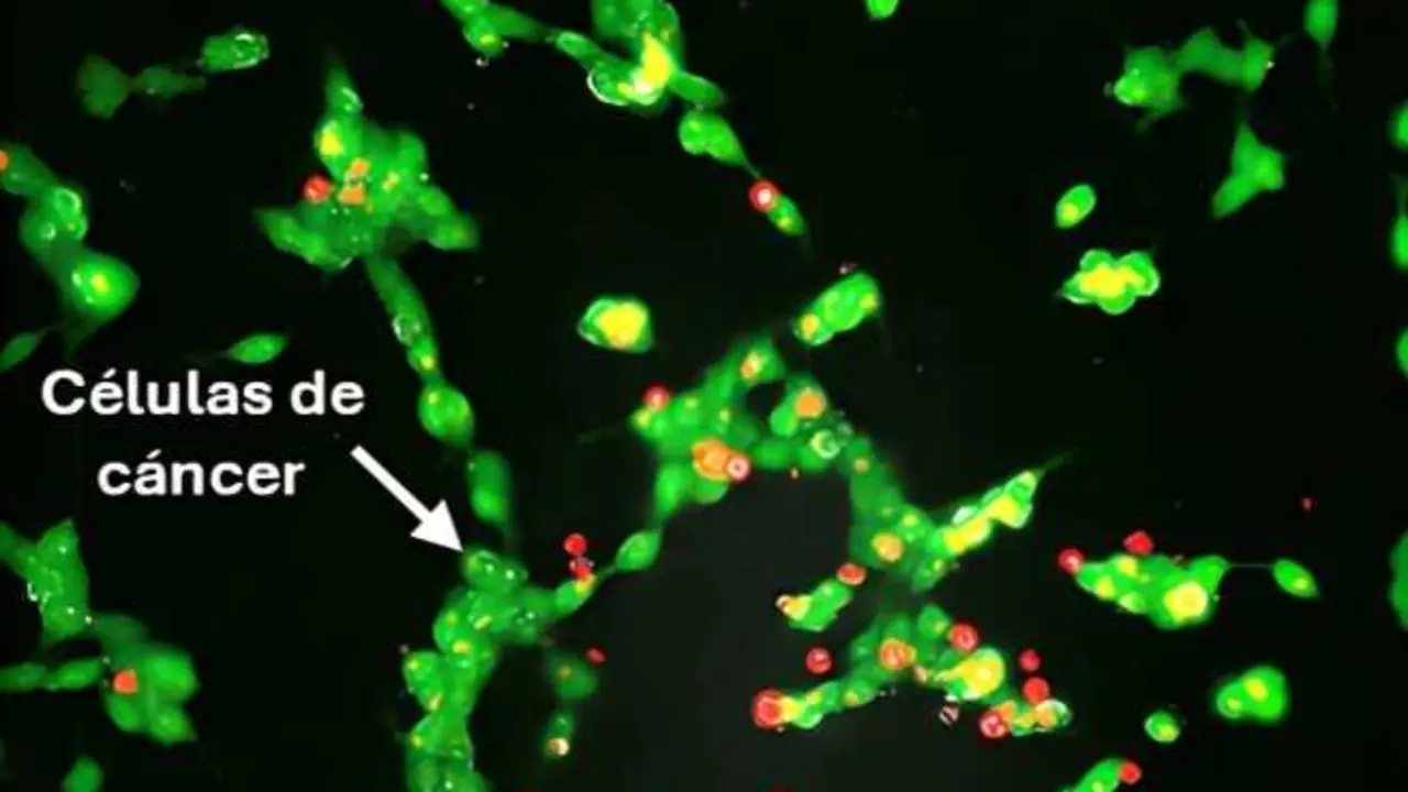 Microscop&iacute;a electr&oacute;nica de c&eacute;lulas de c&aacute;ncer de neuroblastoma tratadas inicialmente con liposomas y posteriormente macr&oacute;fagos modificados con liposomas.