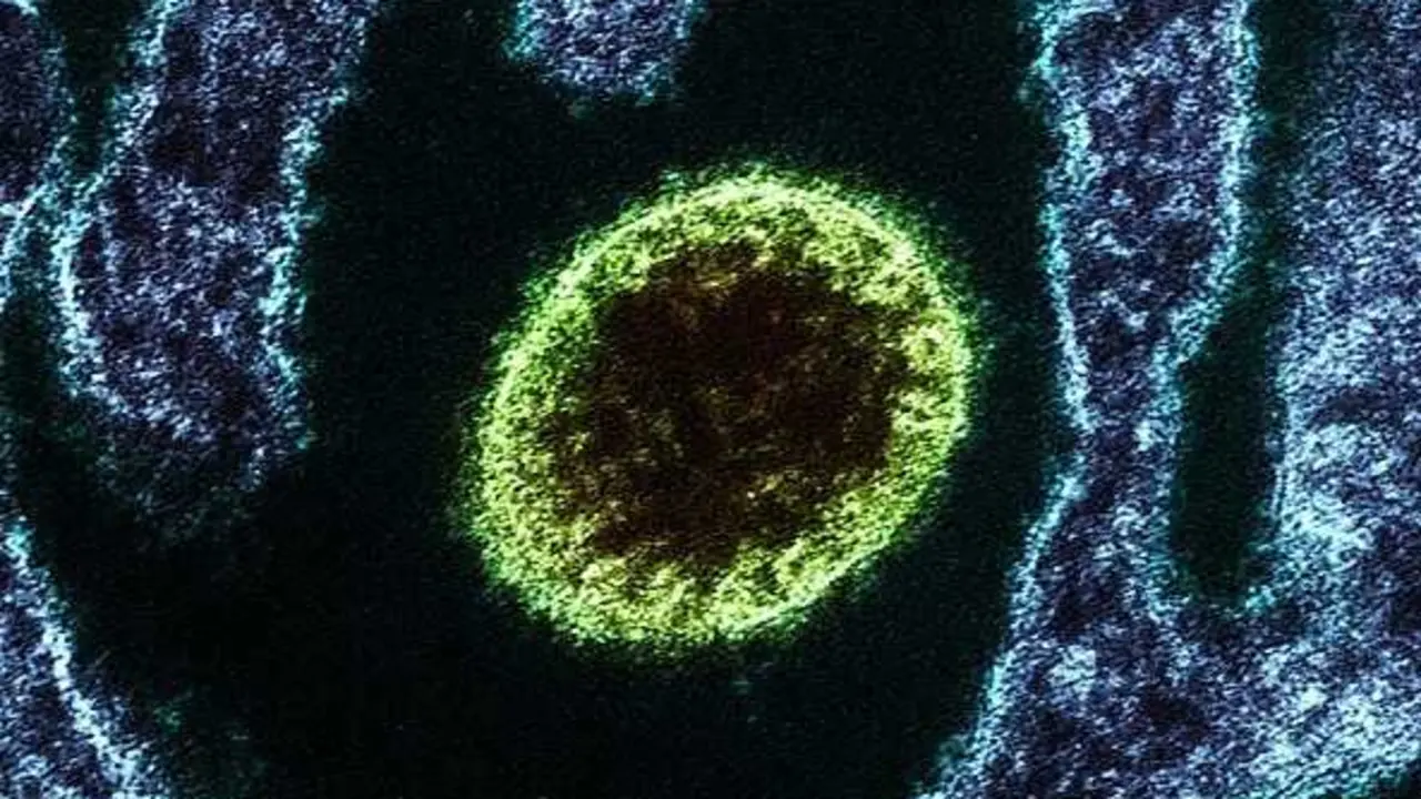IRF - Frederick.07/26/18.10:42:47 a.150000.7.0.80.0.Imaging.#2018-16-B.Nipah Virus (VERO NR596 Cells).Malaysia Strain..234.46176.233.22716.0.00.XpixCal=2.448.YpixCal=2.448.Unit=nm.##fv3
