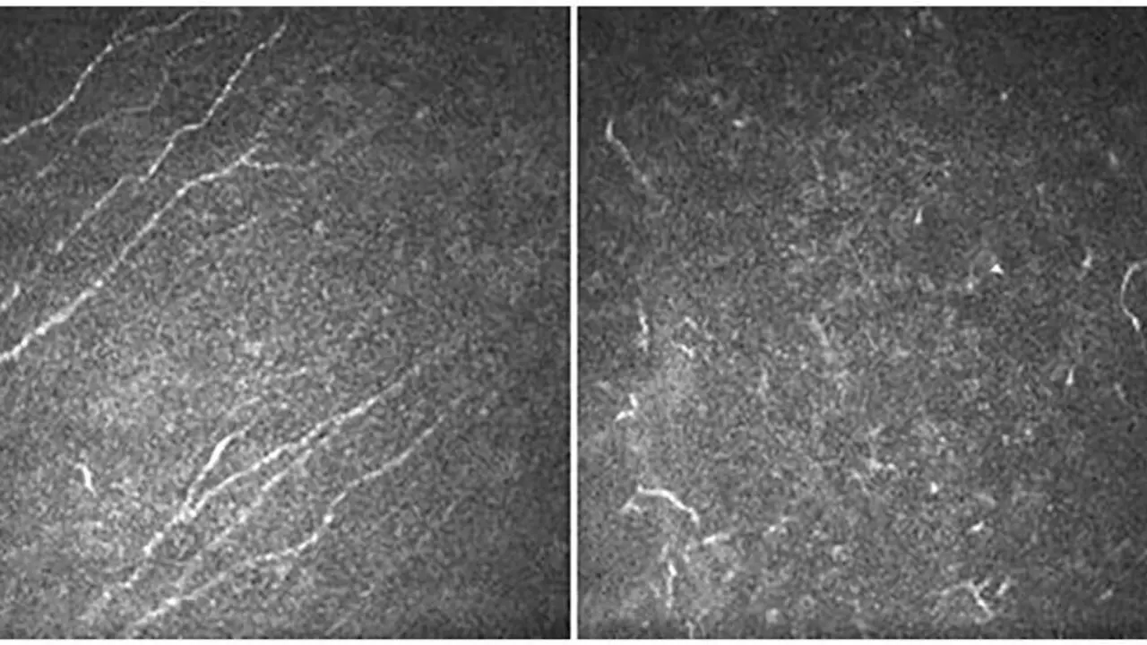 Current Eye Research, 2024. doi: 10.1080/02713683.2024.2320779