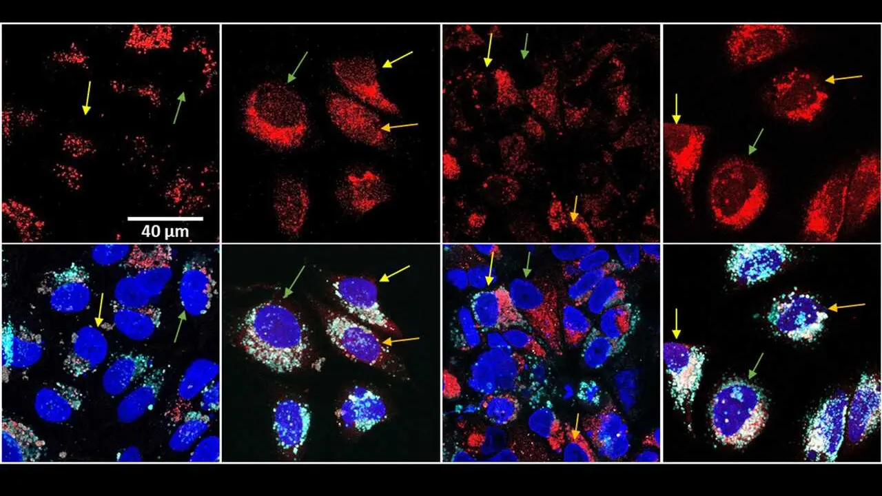 En rojo, el f&aacute;rmaco despu&eacute;s del tratamiento t&eacute;rmico se dispersa por la c&eacute;lula y alcanza el n&uacute;cleo (en azul).