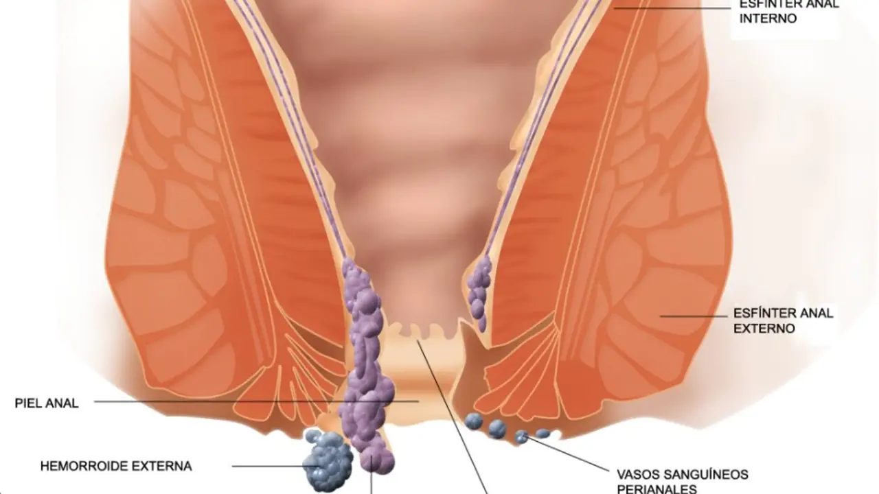 Herromoides. WIKIPEDIA