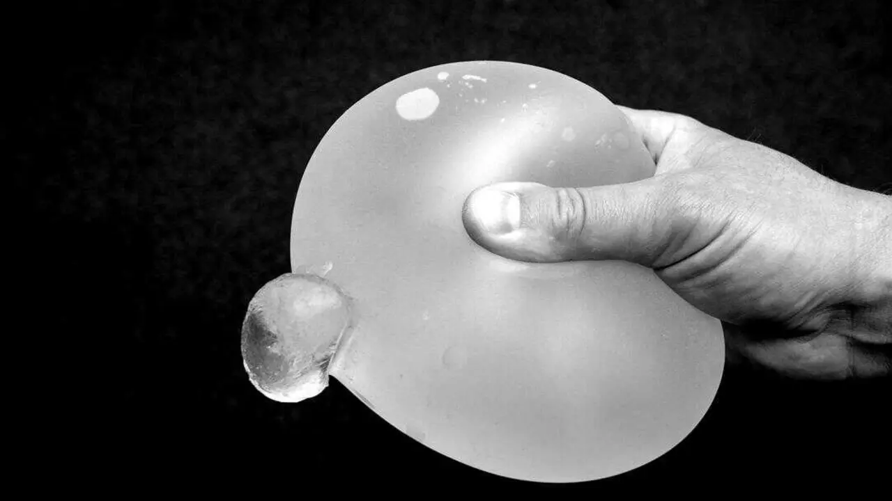 Una de cada diez pr&oacute;tesis mamarias se rompe en los primeros diez a&ntilde;os