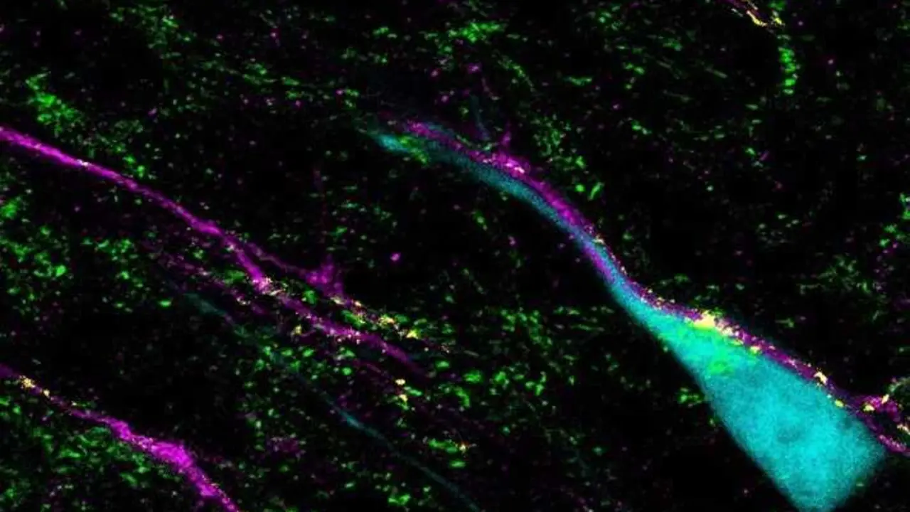 ImageJ=1.53cunit=\u00B5m