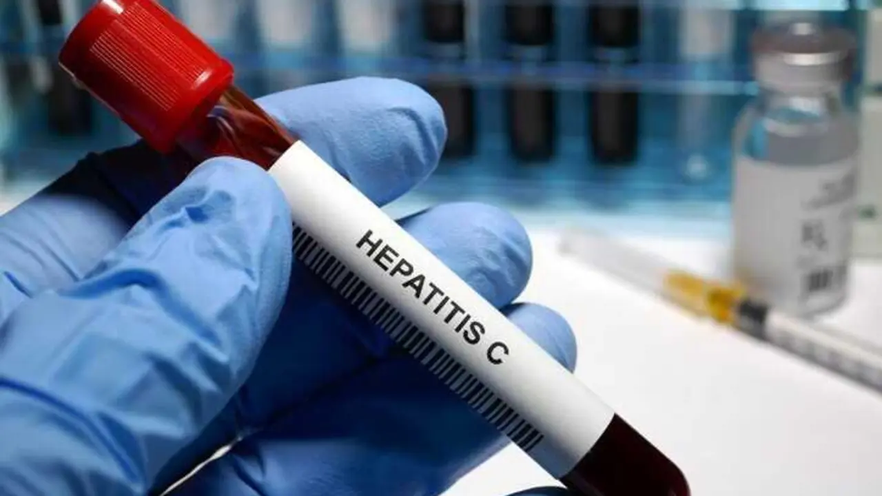 Archivo - Europa no cumple ODS que busca el fin de VIH y tuberculosis y combatir hepatitis viral e ITS, con 59.000 muertes al a&ntilde;o