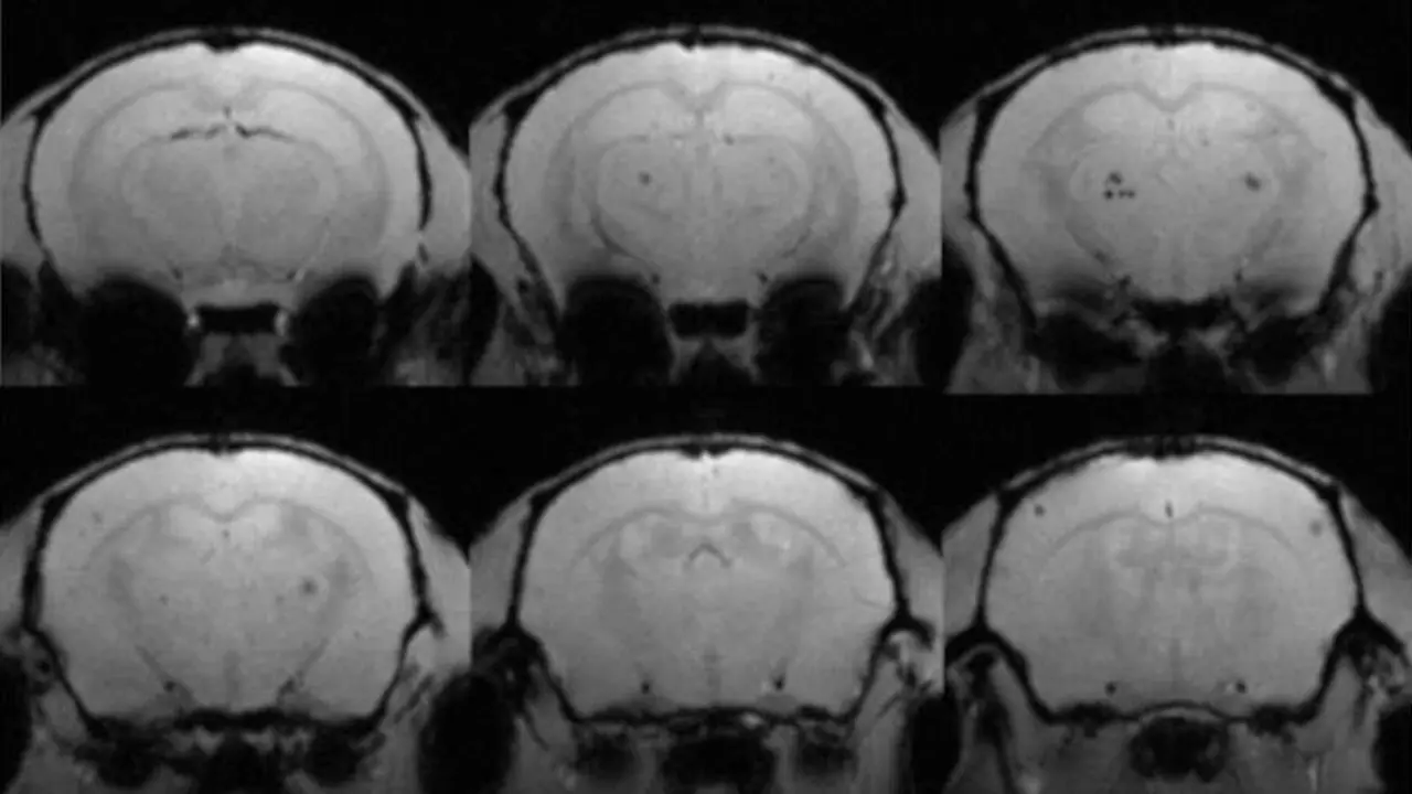 Seis secciones de cerebros de rat&oacute;n con microhemorragias