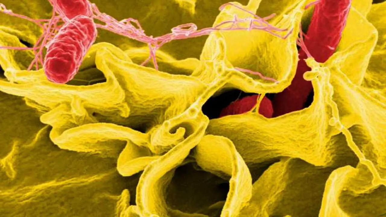 Archivo - Bacteria salmonella, salmonela