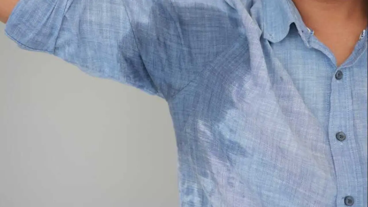 Experta destaca los tratamientos avanzados en hiperhidrosis axilar, que puede reducirse hasta en un 70%