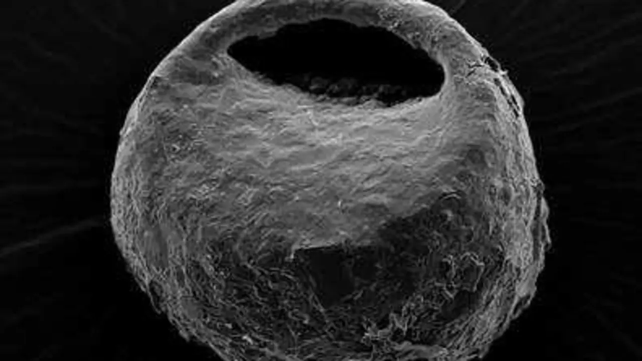 Imagen de microscop&iacute;a electr&oacute;nica de la especie terrestre Centropyxis orbicularis.