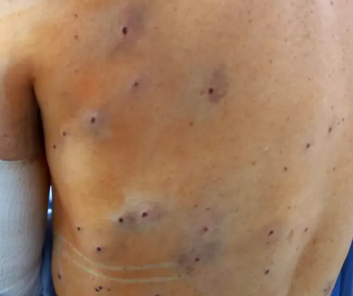 Captura de pantalla (182)